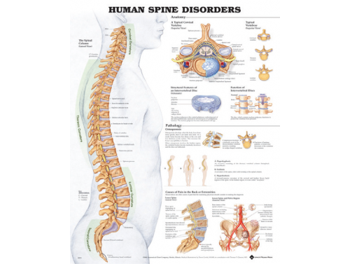 BODYLINE HUMAN SPINE DISORDERS CHART - LAMINATED