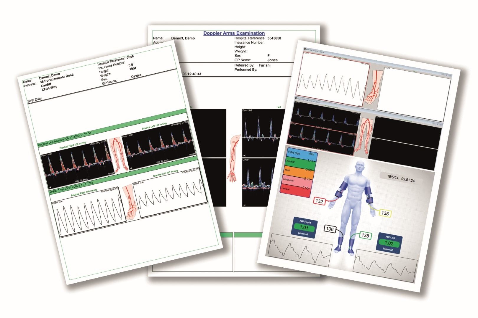 HUNTLEIGH DOPPLEX DR5 PATIENT RECORD SOFTWARE photo