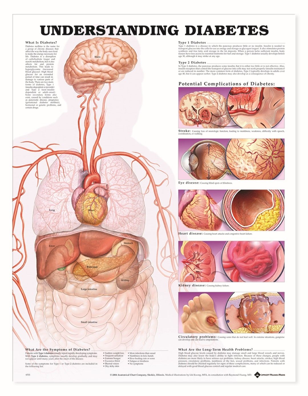 BODYLINE UNDERSTANDING DIABETES CHART photo