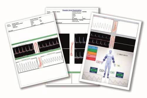 HUNTLEIGH DOPPLEX DR5 PATIENT RECORD SOFTWARE