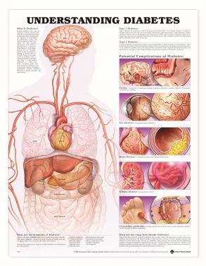 BODYLINE UNDERSTANDING DIABETES CHART