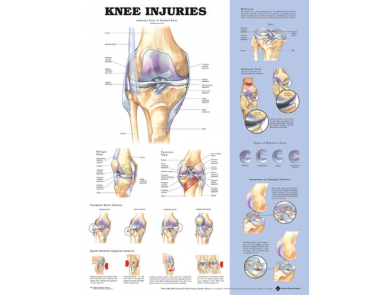 BODYLINE KNEE INJURIES CHART - LAMINATED