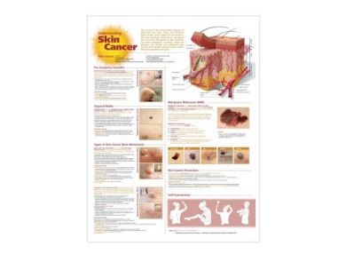 BODYLINE UNDERSTANDING SKIN CANCER CHART